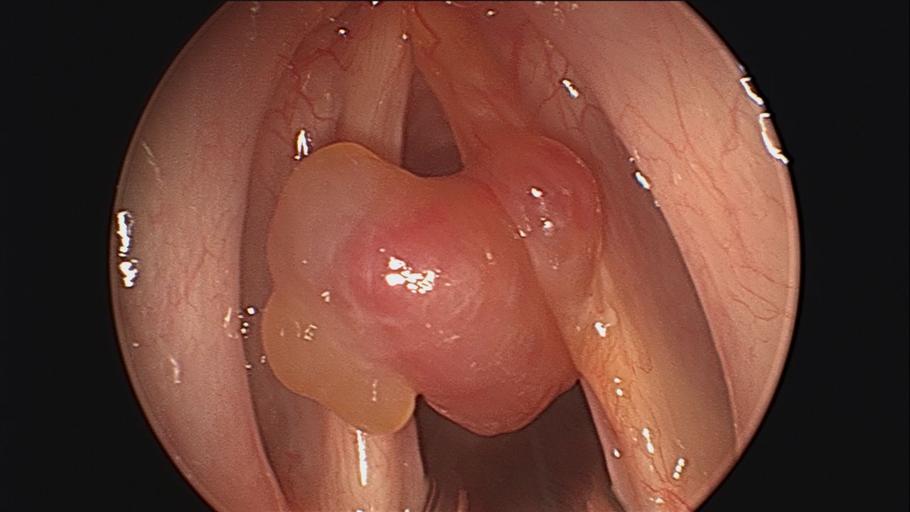 Eduardo Ivan Acuña Ramirez-9