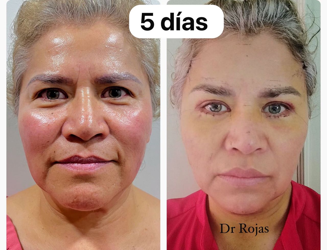 Francisco Rojas Aguilar-22