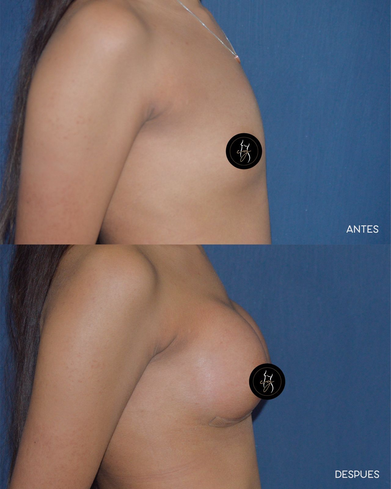 Carlos Alberto Gaitán García-4