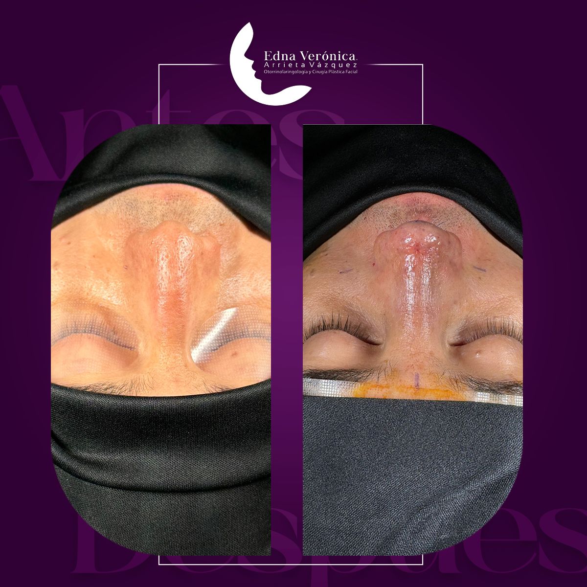 Edna Verónica Arrieta Vázquez-7