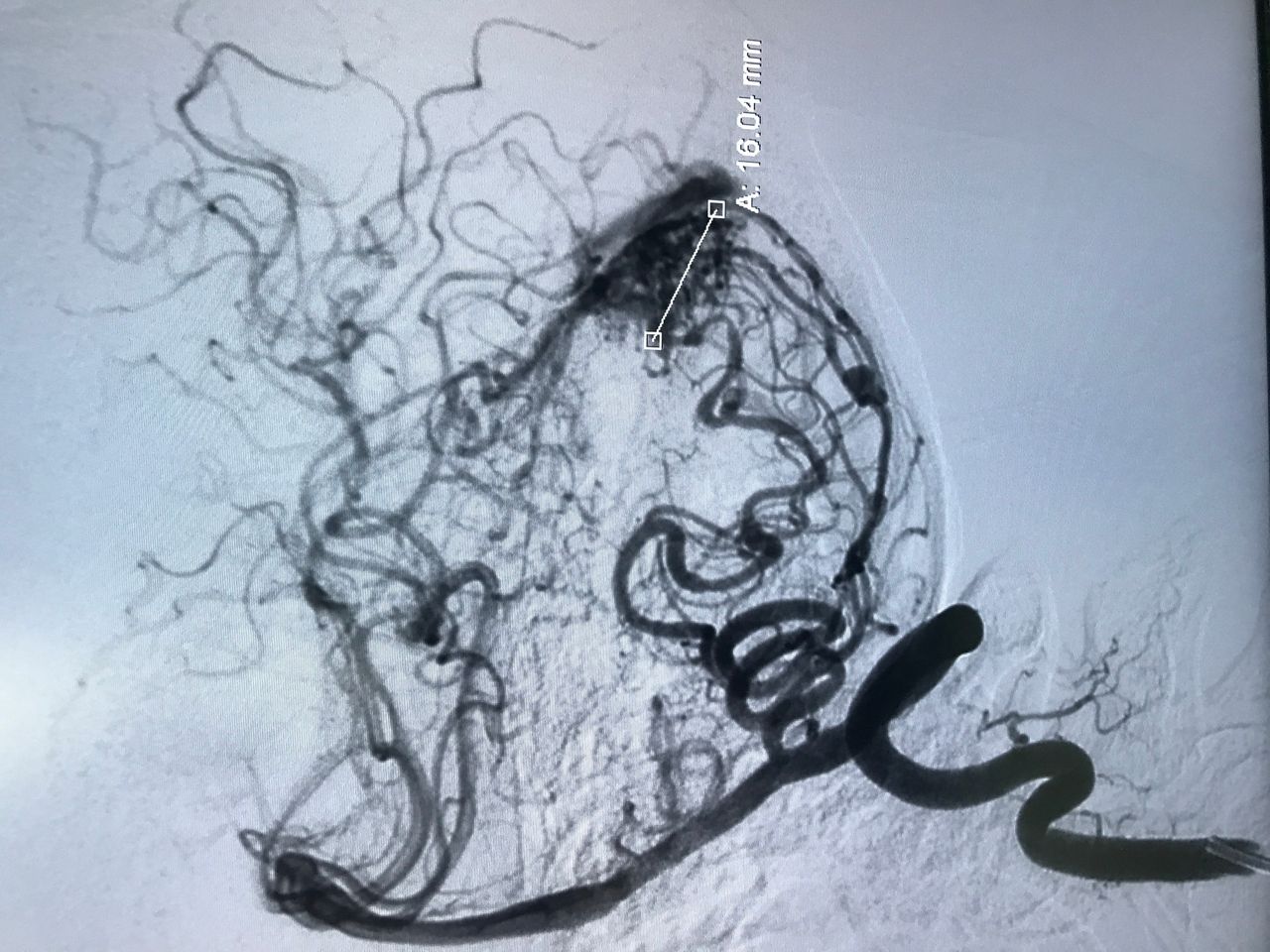 Edgar Fernando Acosta Gomez-4