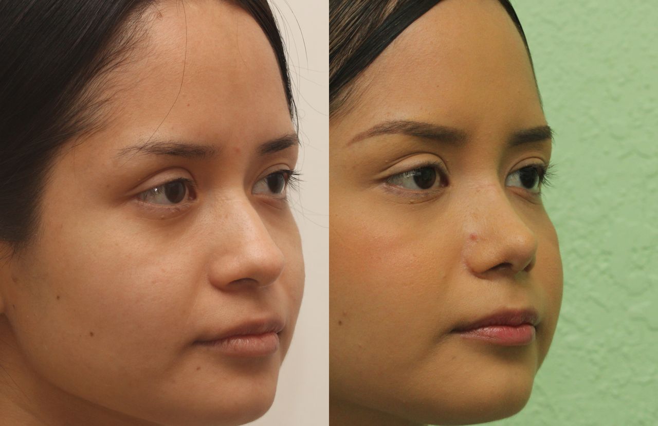 Angel Castro Urquizo-194