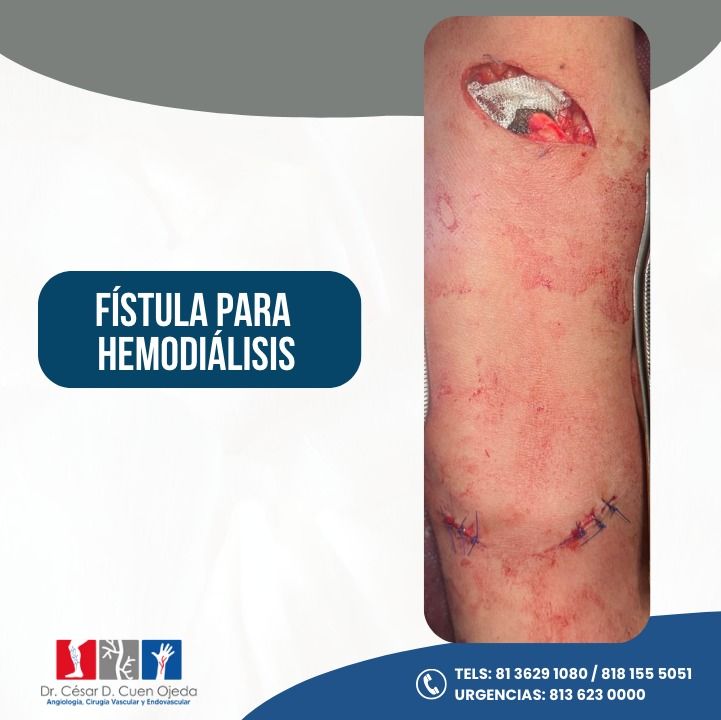 César Daniel Cuen Ojeda-15