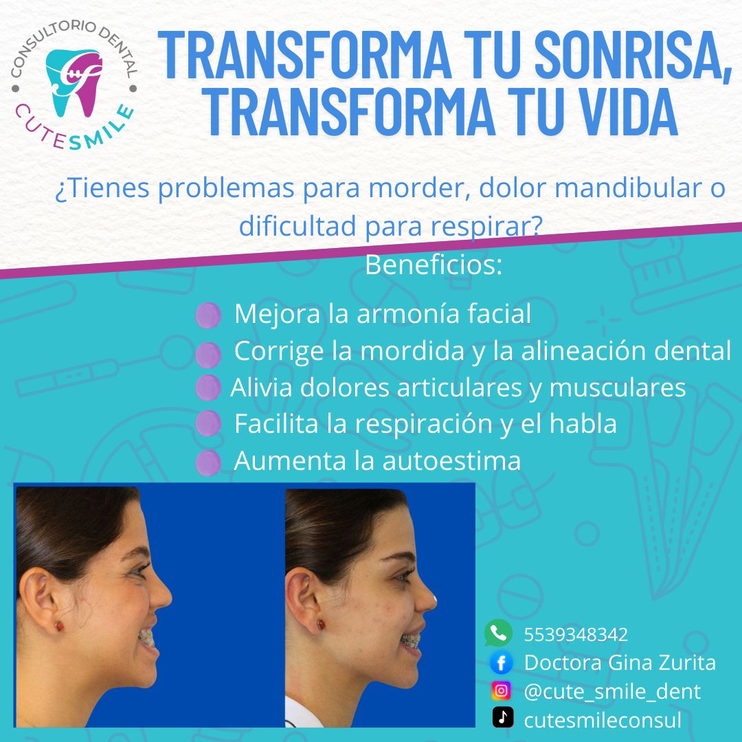 Georgina Zurita Rdz-9