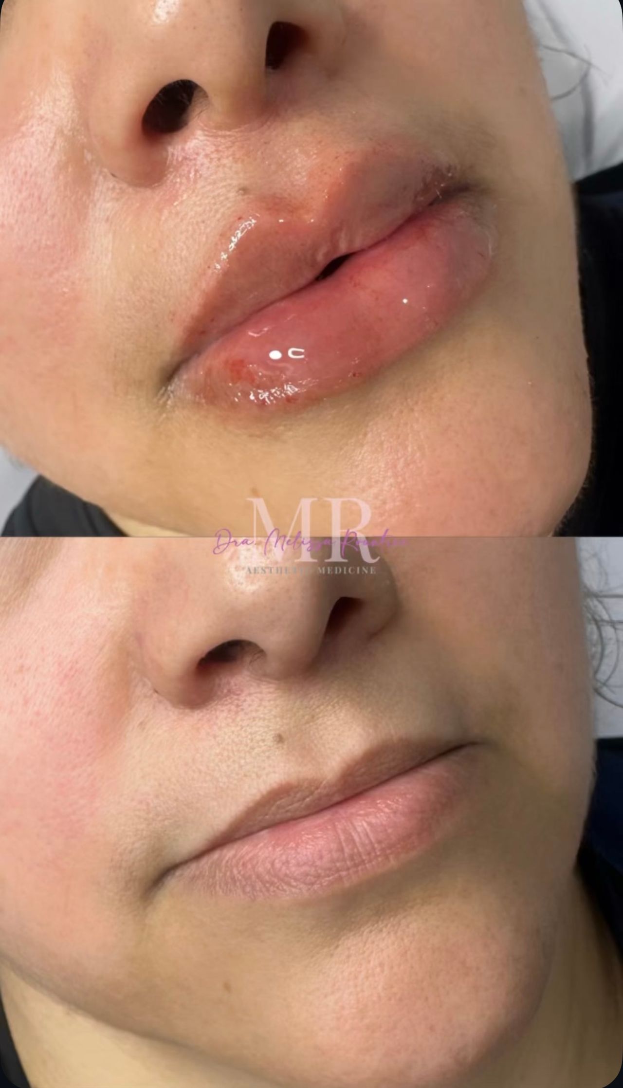 Melissa G. Rountree-25