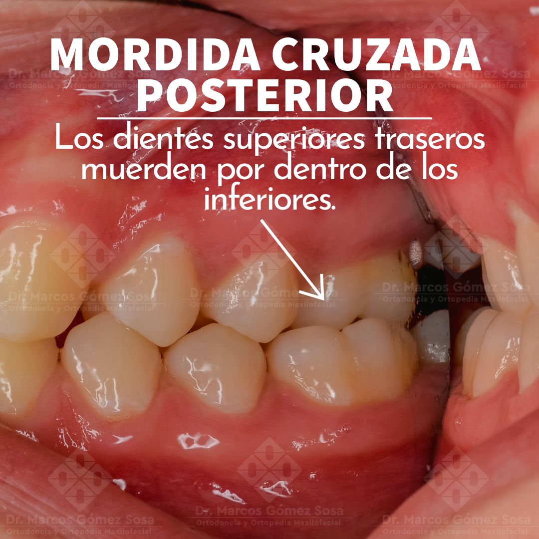 Marcos Gómez Sosa-69