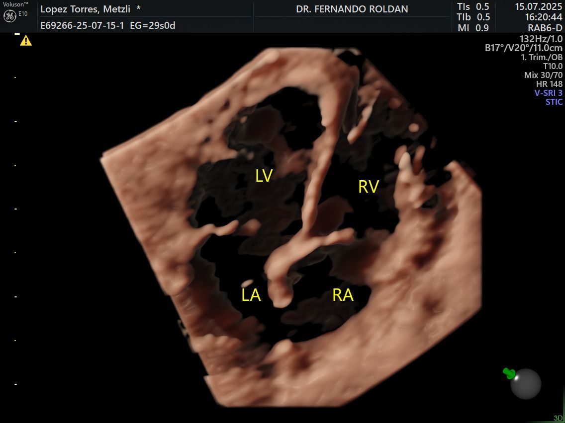 Fernando Roldan Arce-6