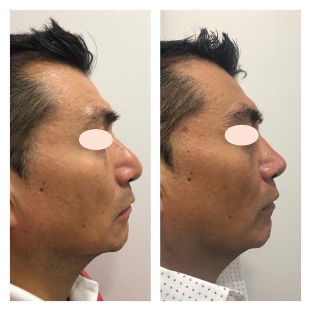 Carola Berenice Curiel Davalos-31