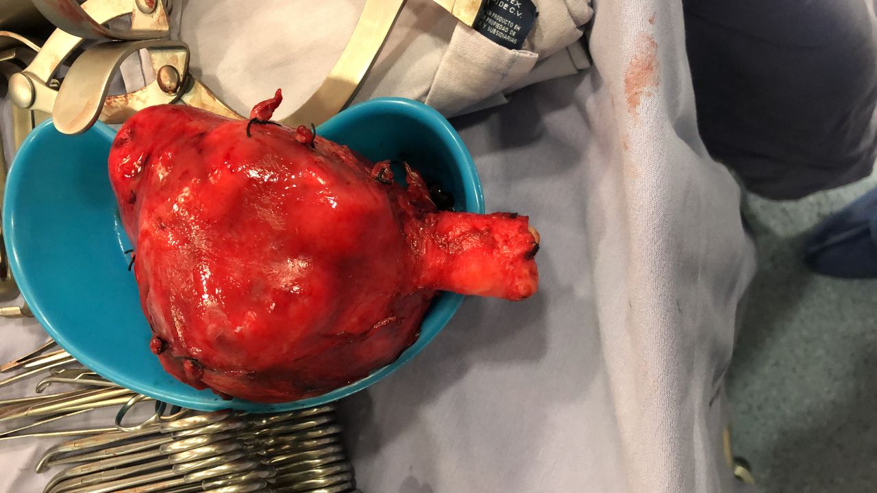 Brenda Anaid Torres Ugalde-21