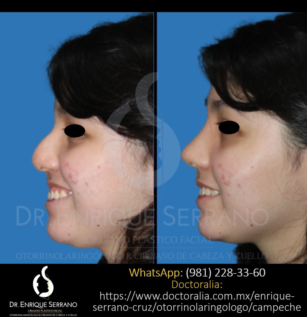 Enrique Serrano Cruz-47