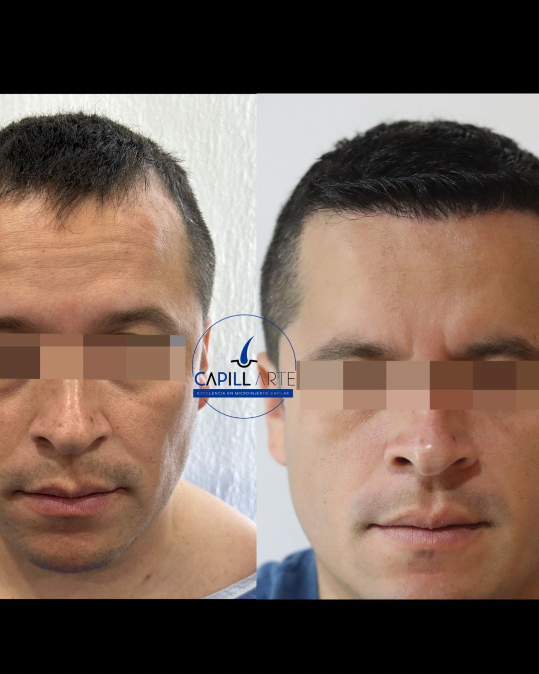 Adrian Hernandez Lopez-16