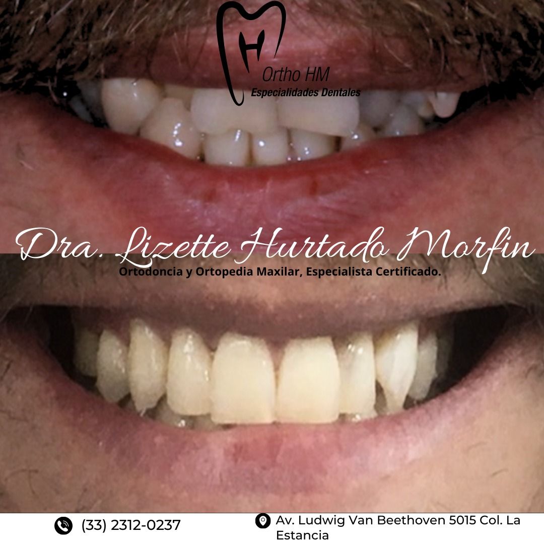 Lizette S. Hurtado Morfin-4