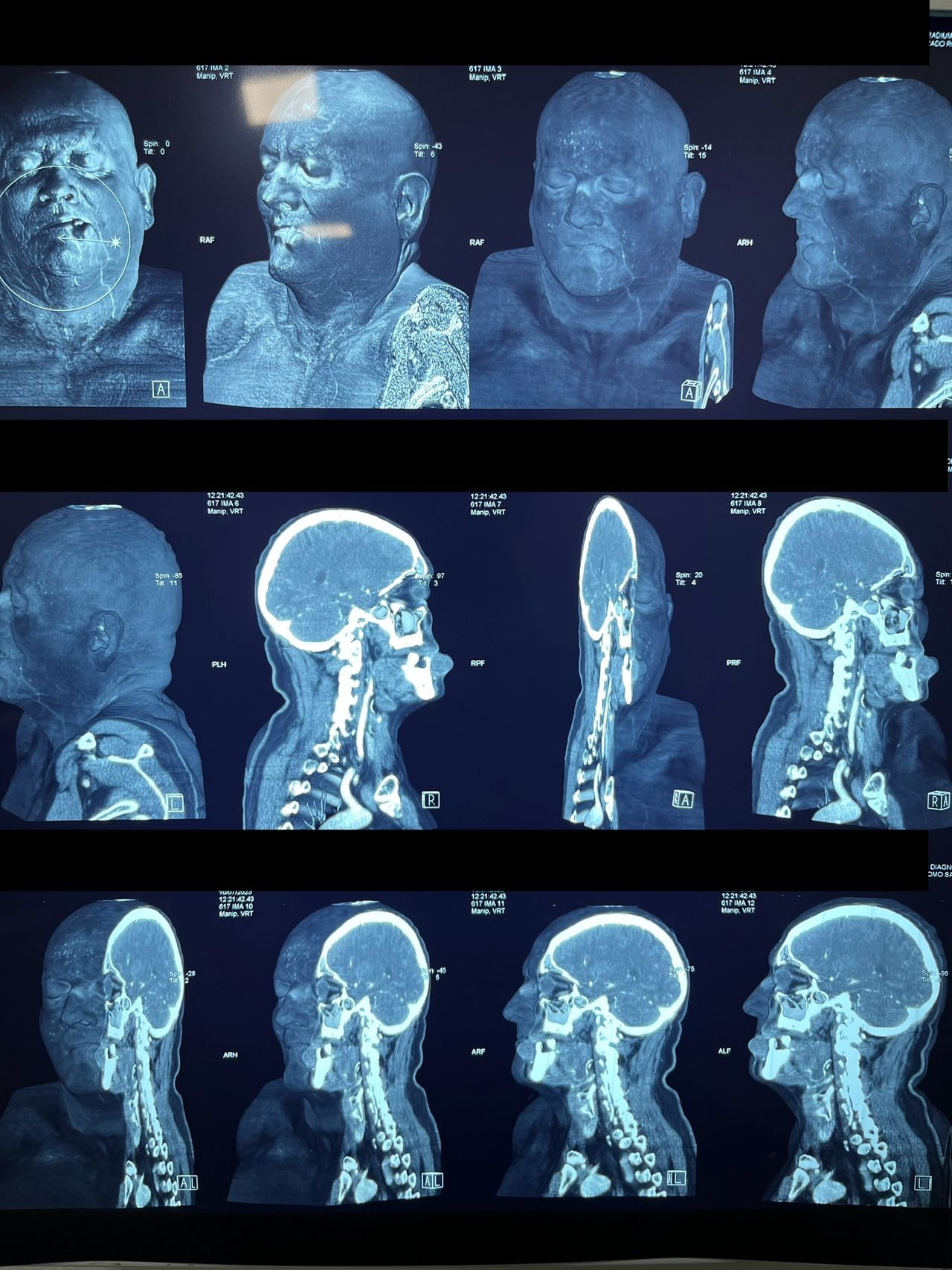 Nicolás Serrano Heredia-0