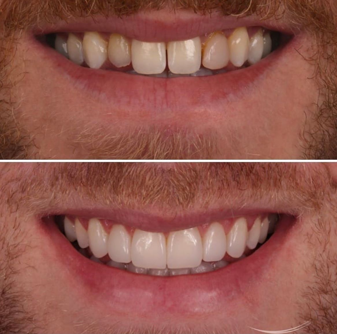 Ernesto Rojas Calderon-35