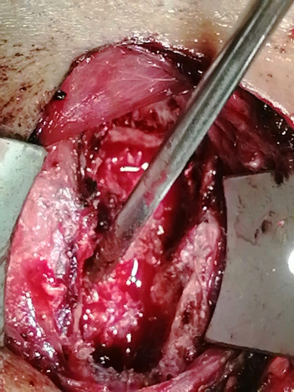 Juan José Luévano De La Cruz-33