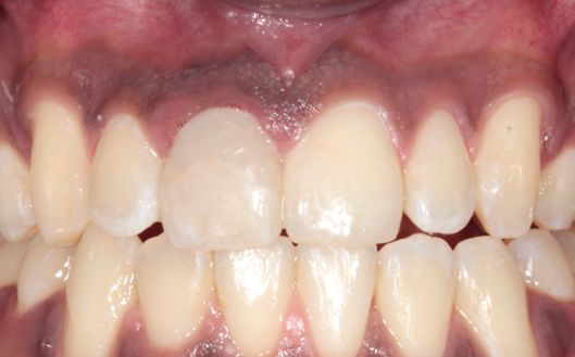 Mariel Itzayani Torres López-16