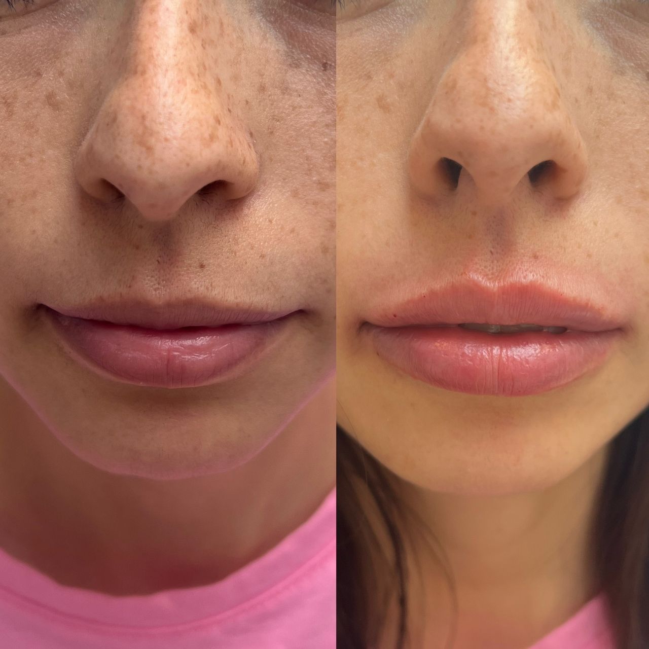 Venecia Landini Enríquez-6