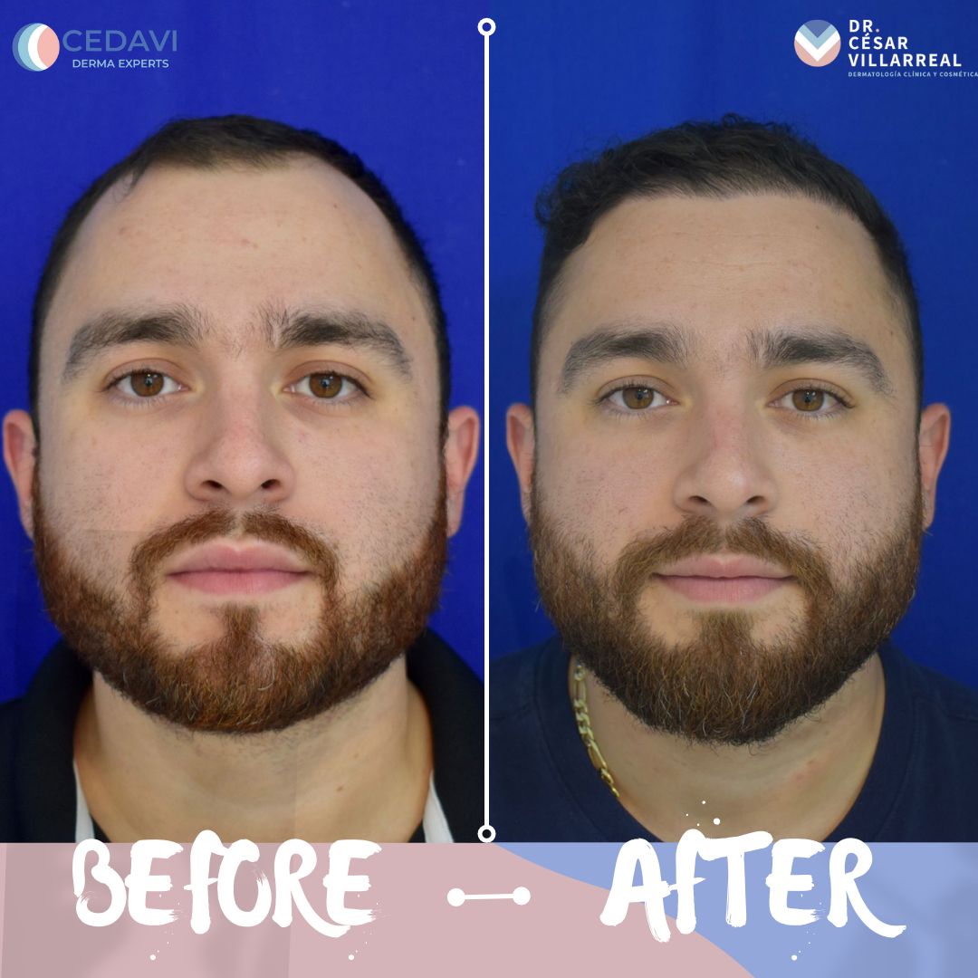 César Daniel Villarreal Villarreal-21