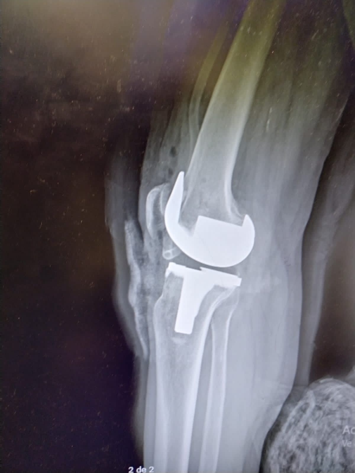 Carlos Horacio Sanchez Rodrigo-25