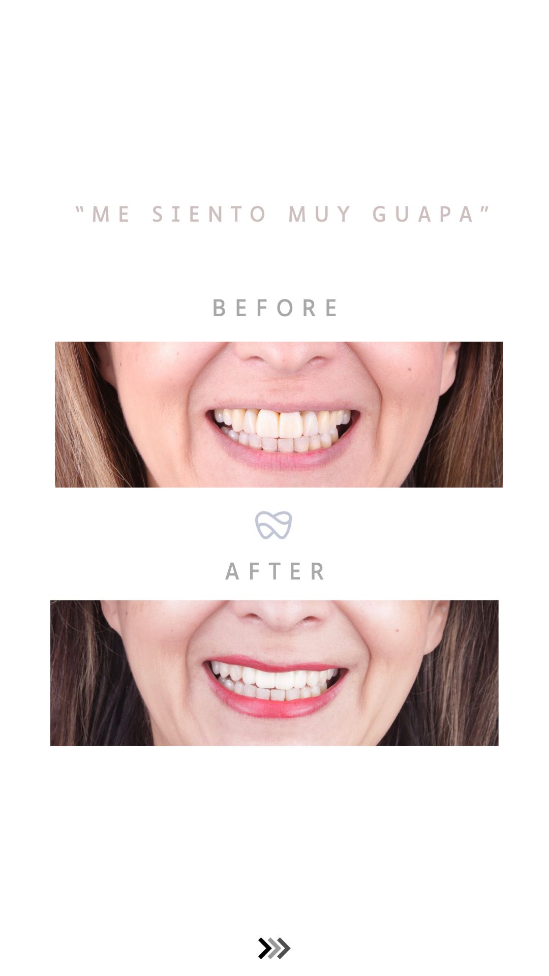 Erick Perea Santillán-4