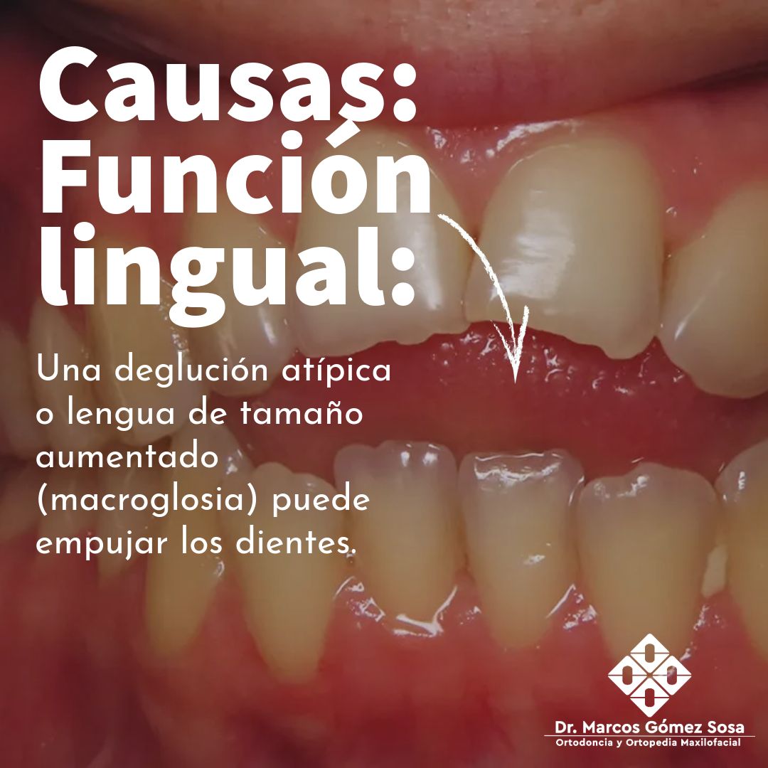 Marcos Gómez Sosa-45