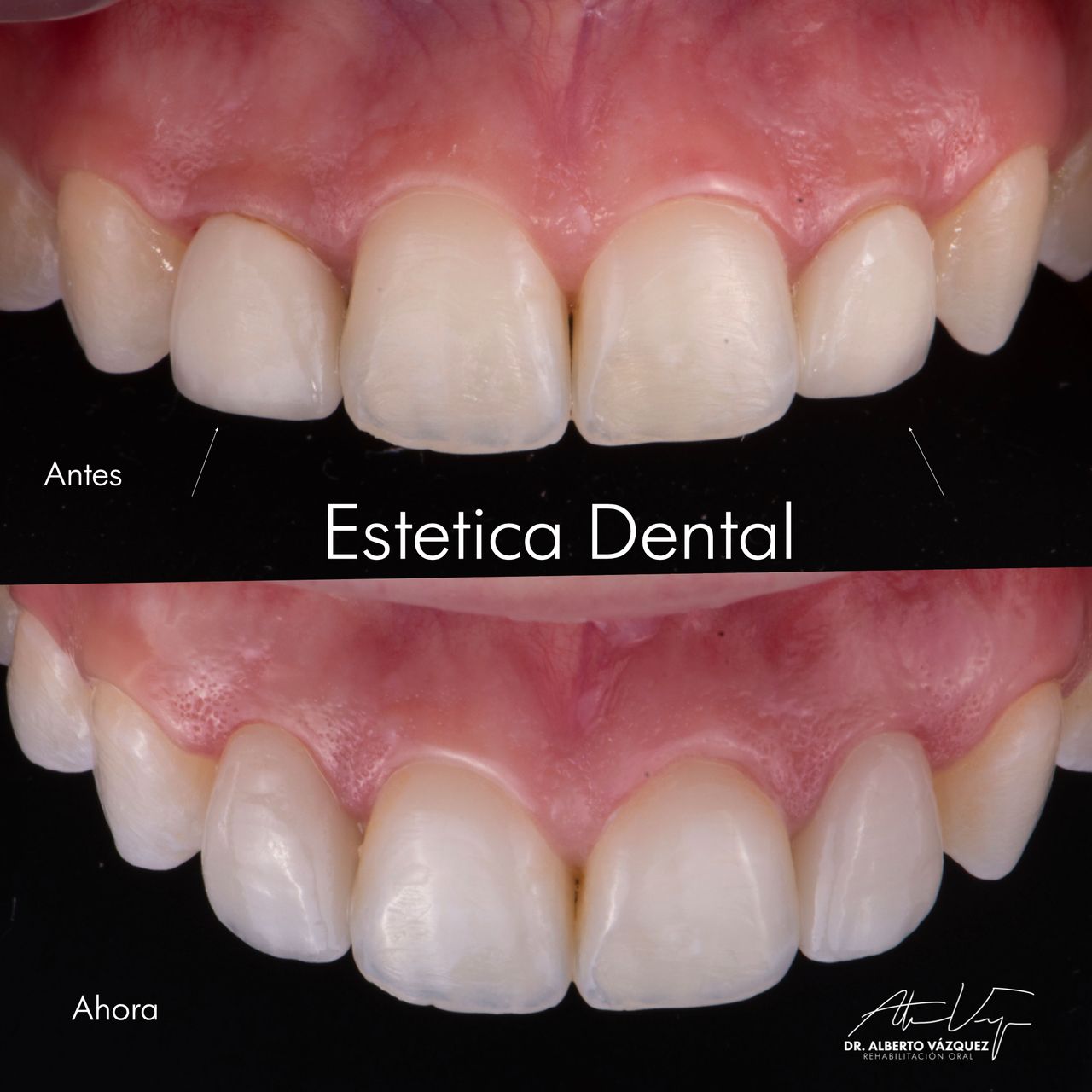 Alberto Vázquez Zavala-4