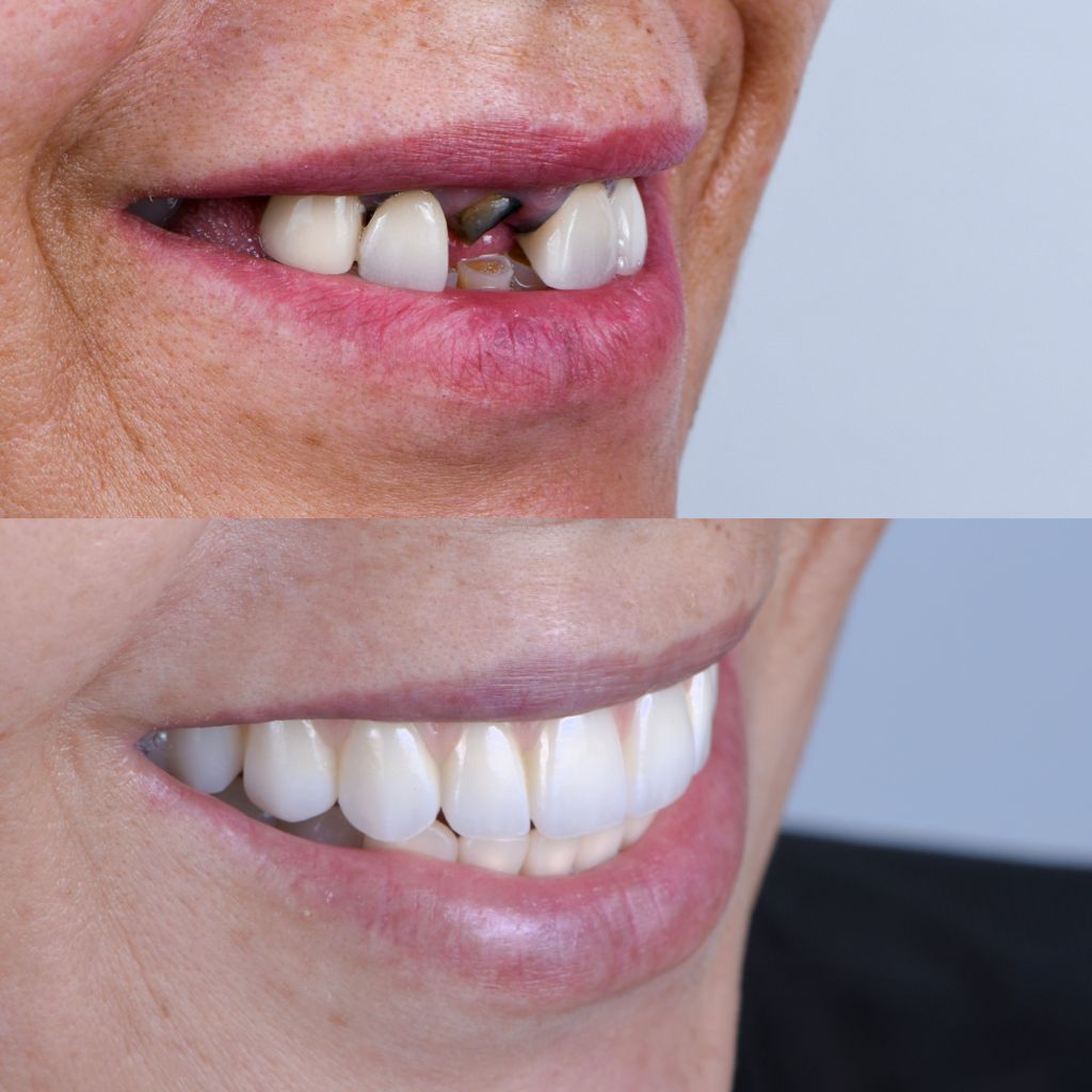 Ricardo López Lemus-136