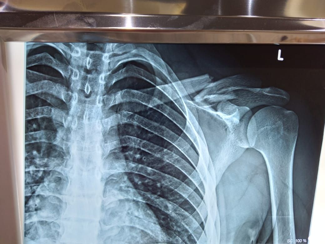 Jeftte Aaron Chacon Martinez-3