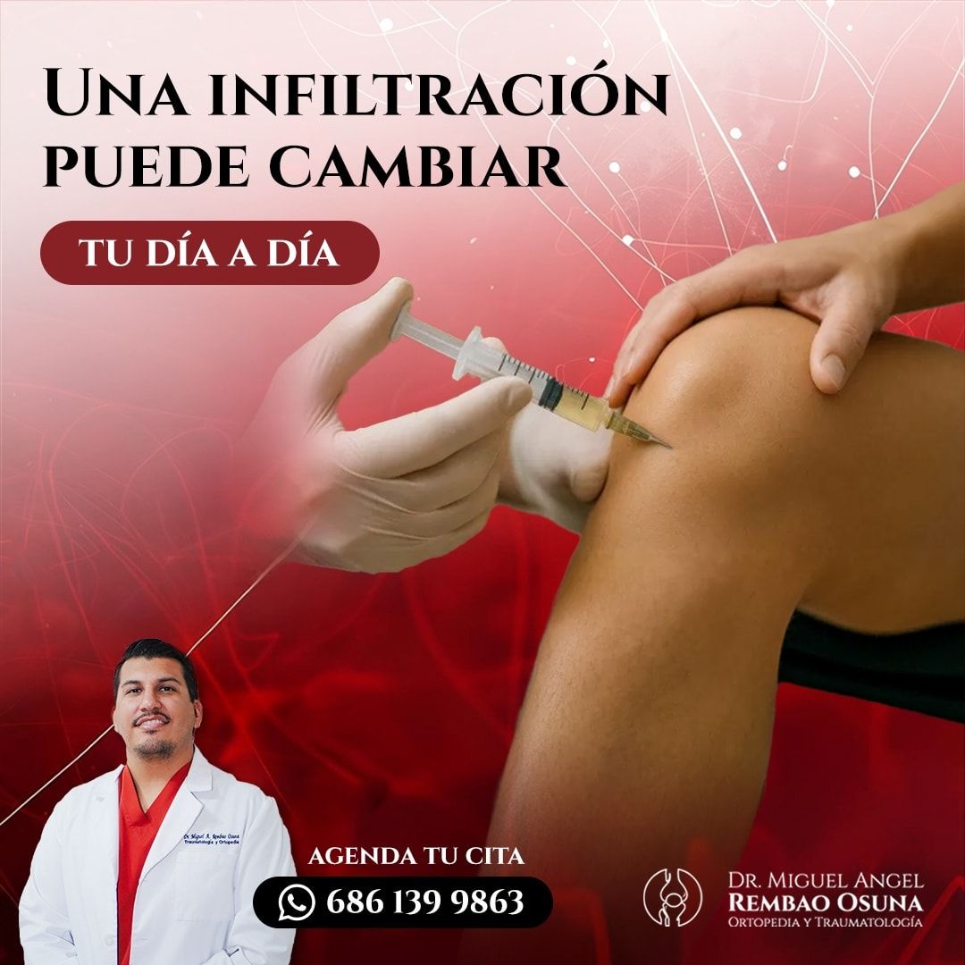 Miguel Angel Rembao Osuna-0