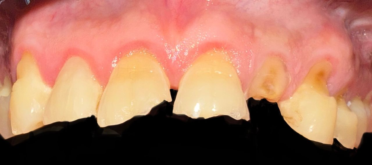 Jair Contreras García-64