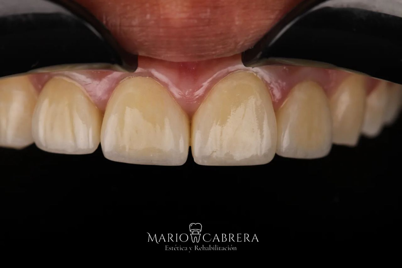 Mario Francisco Cabrera Ballona-5