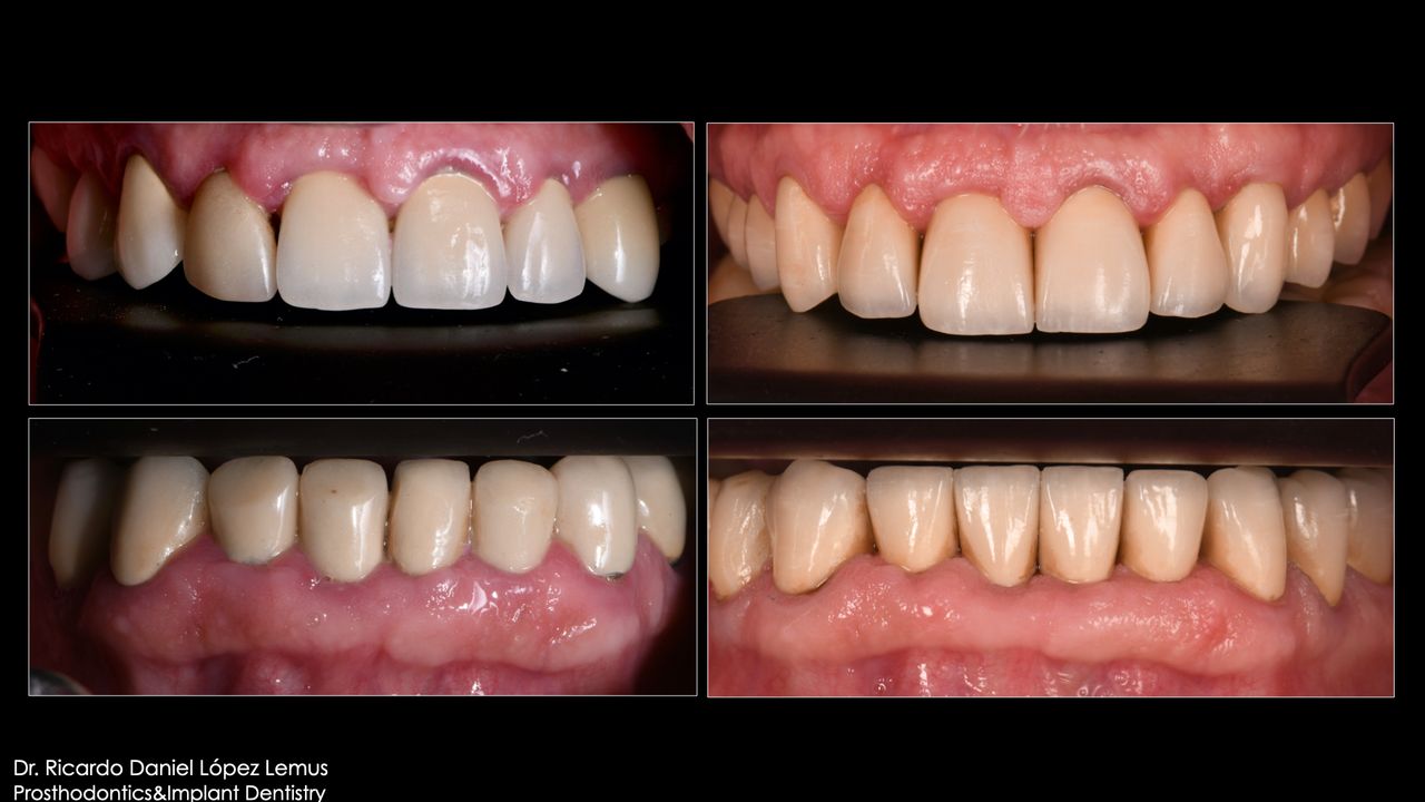 Ricardo López Lemus-45