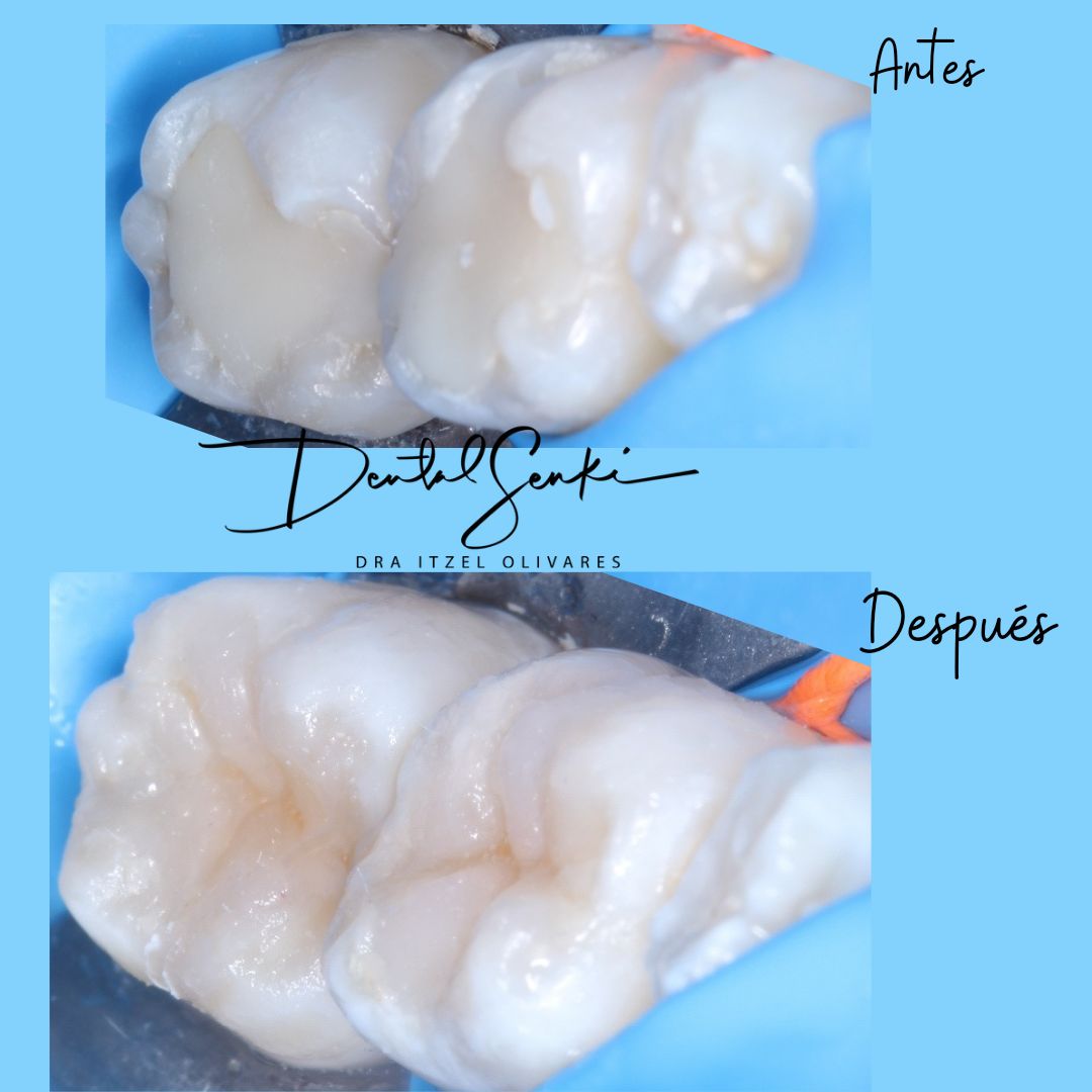 Itzel Olivares Lara-23