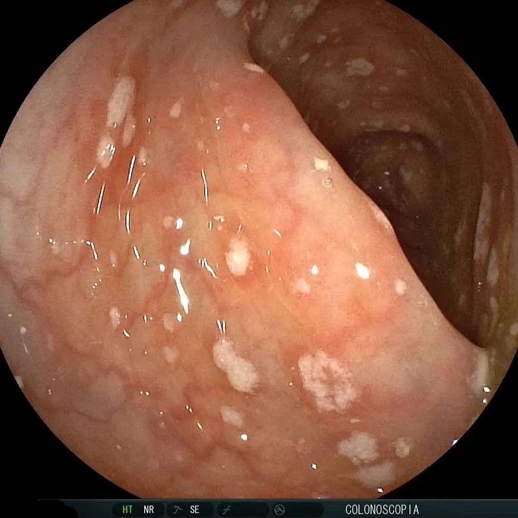 Edgar Alan De León Rojas-6