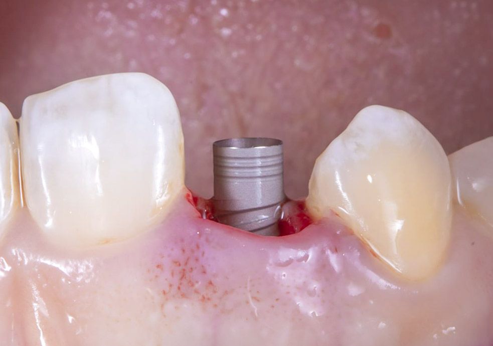 Hugo Enrique Aguilar Lamas-93