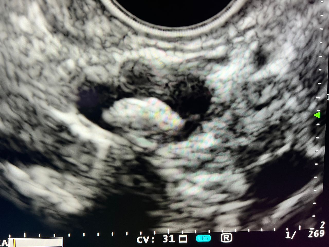 Everardo Muñoz Anaya-3