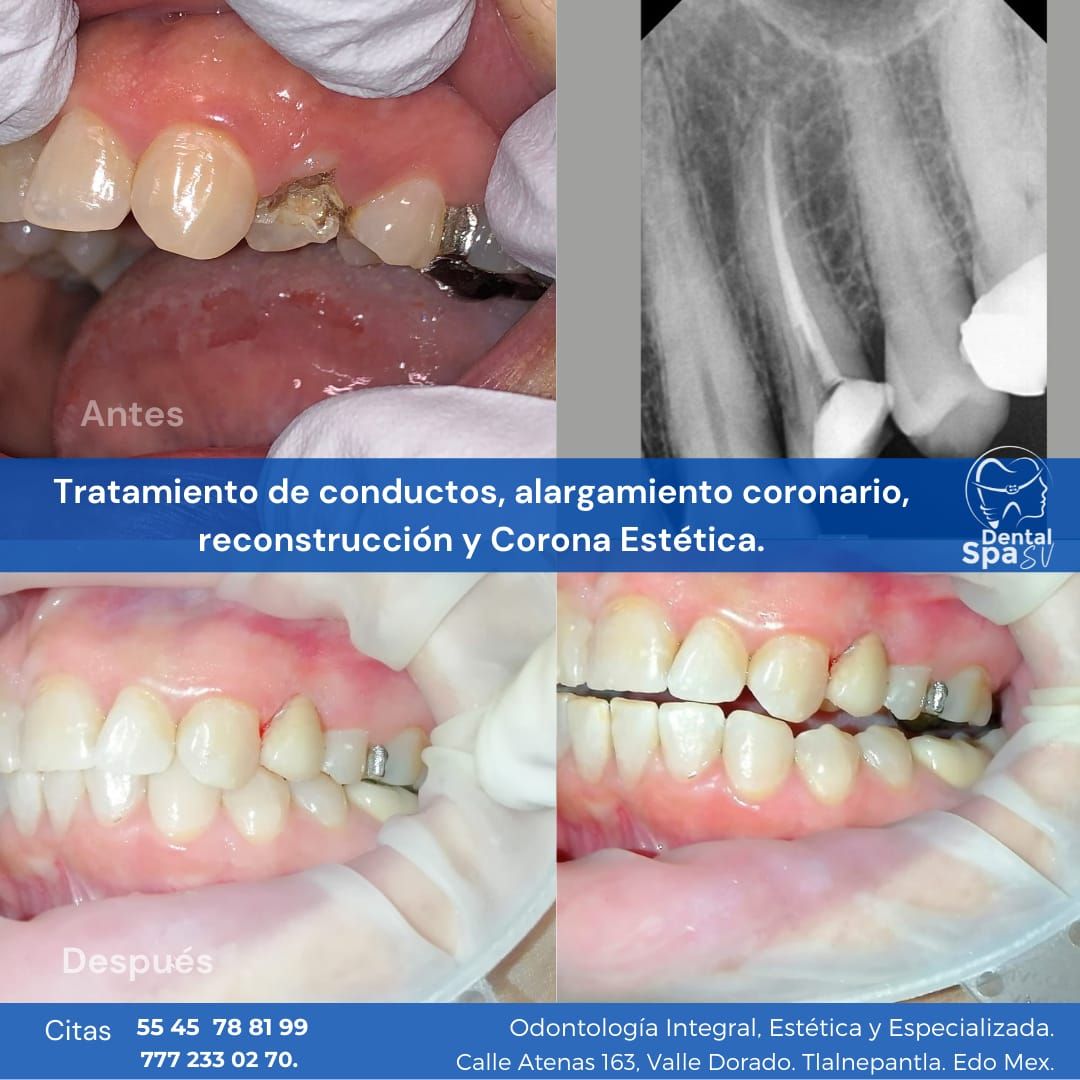 Zury Sarai Moreno Soto-46