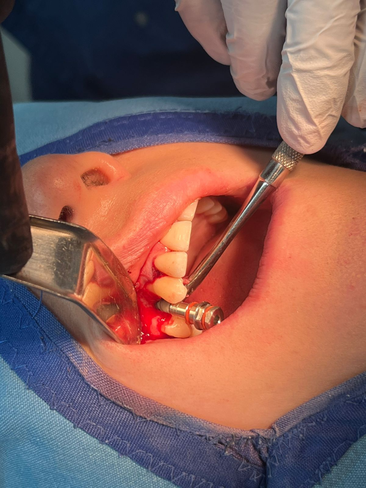 Jair Contreras García-39