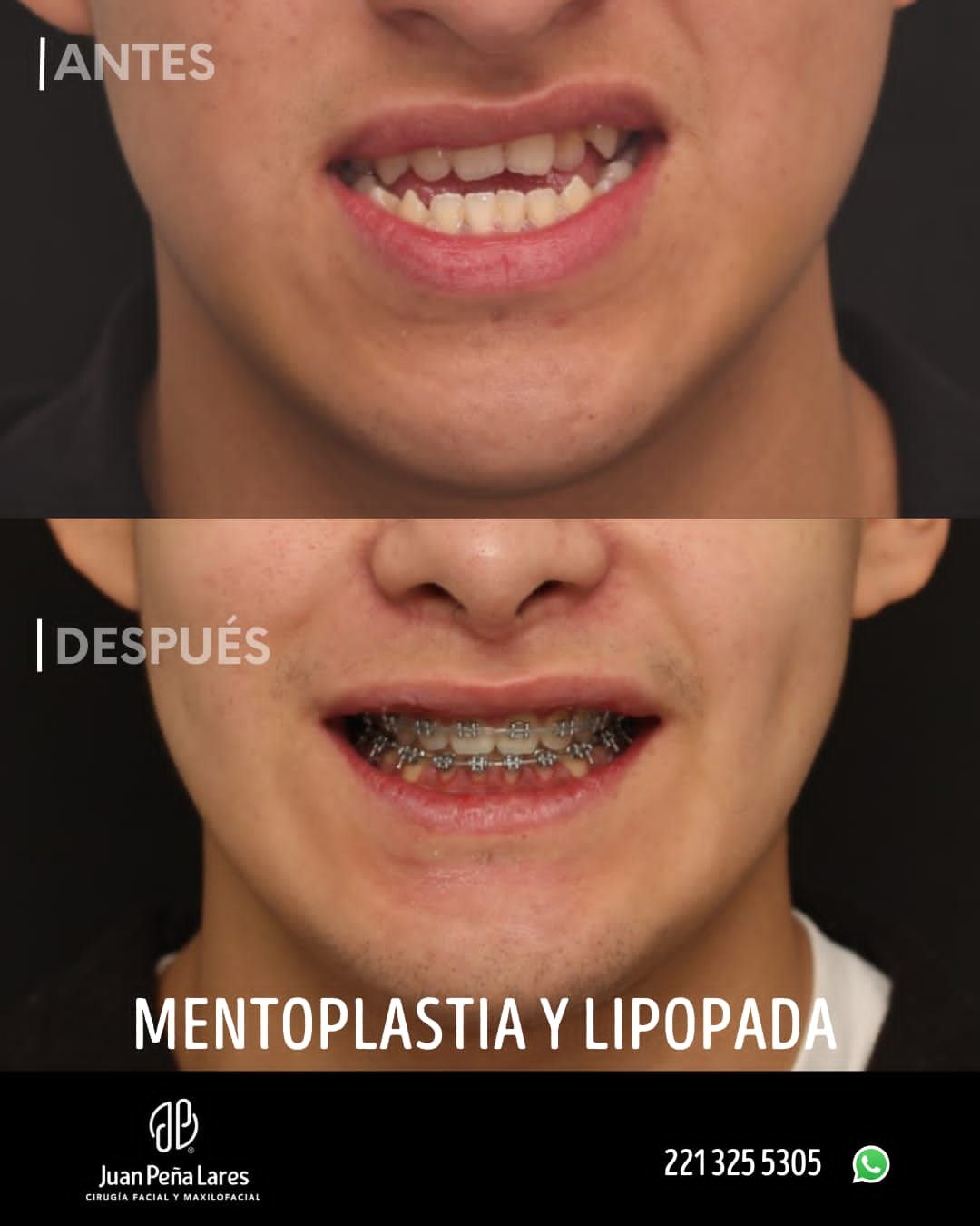 Juan Peña Lares-19