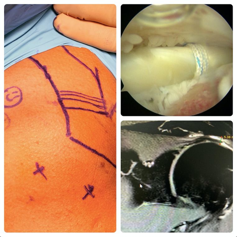 Luis Iram Lozano Parra-9