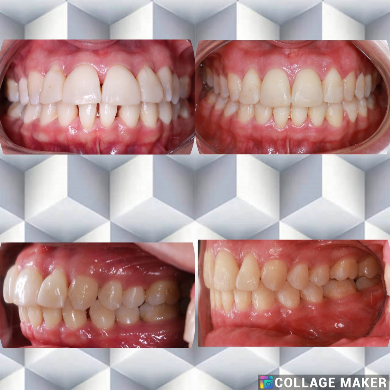 Ryan Michael Brenes Pacheco-17