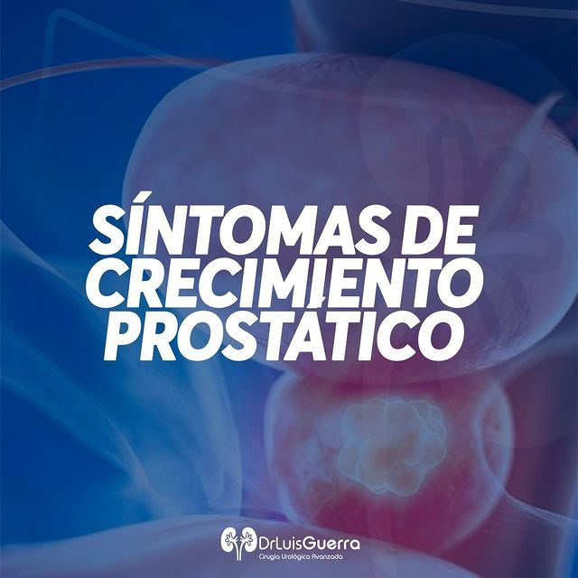 Luis Alberto Guerra Zepeda-75