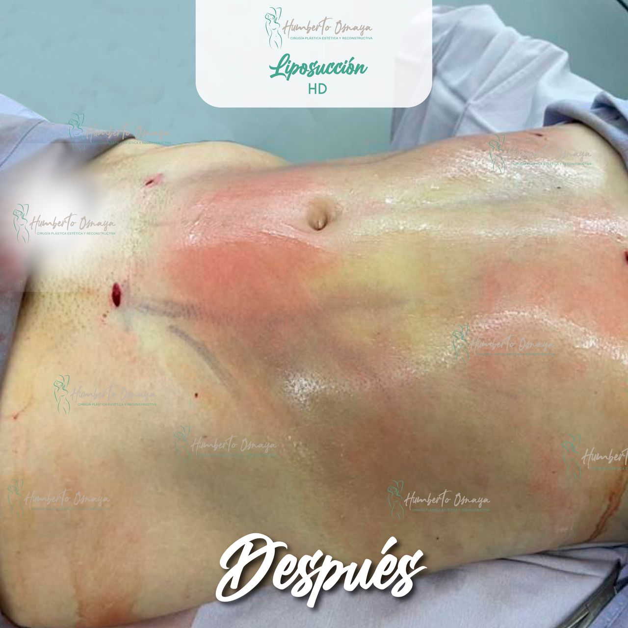 Humberto Osnaya Moreno-16