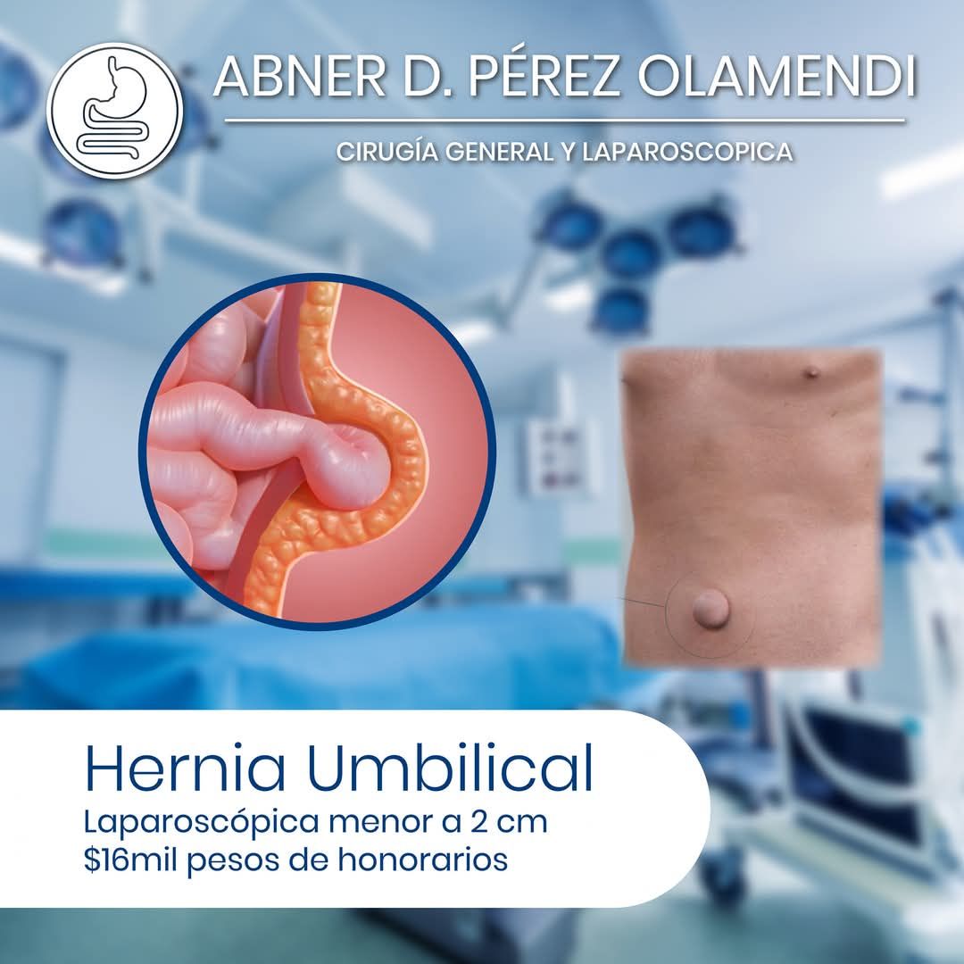 Abner Daniel Pérez Olamendi-13