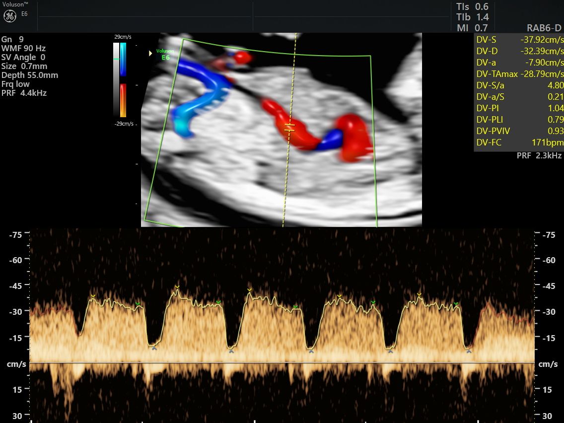 Gila Lili Barrientos Chavez-2
