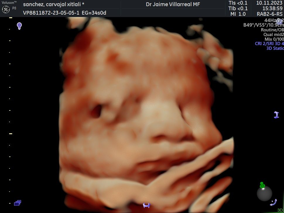 Jaime Alberto Villarreal Lopez-11