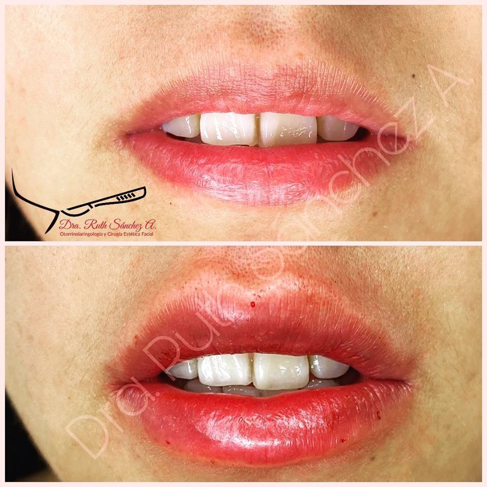 Ruth Sánchez Alvarez-10