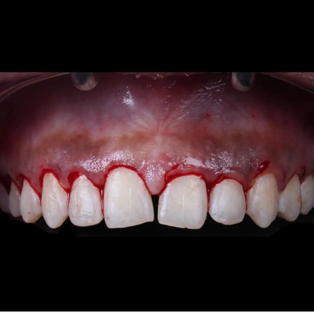 Hugo Enrique Aguilar Lamas-56