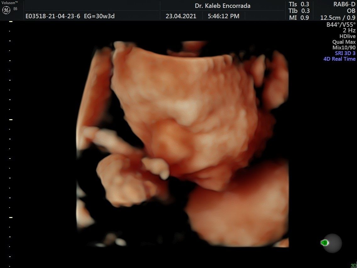 Hugo Kaleb Encorrada Luarca-21