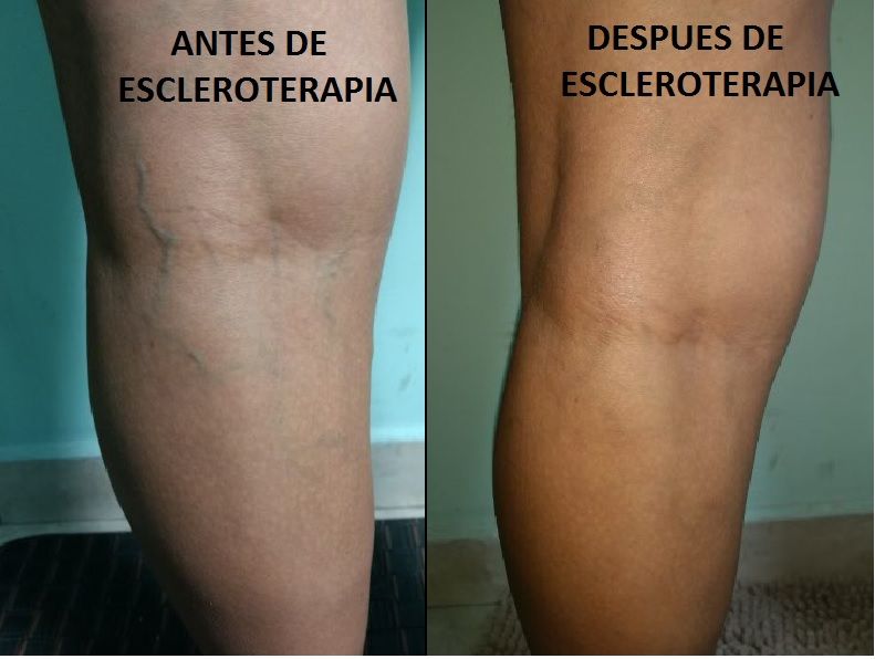 Marco Antonio Ayala García-3